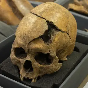 Vědci Objasnili Původ Záhadných Zranění Lebek Z Bitvy U Visby Z Roku 1361