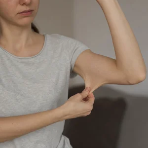 Ehlers-Danlosův Syndrom: Vzácné Onemocnění Pojivové Tkáně A Jeho Projevy