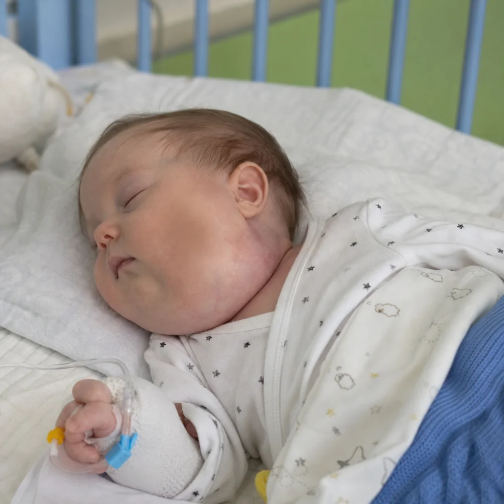 Lymfatické Malformace: Vzácná Vrozená Porucha Lymfatických Cév Ohrožuje Už Děti